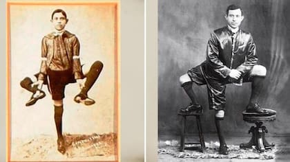 Frank Lentini, el hombre de tres piernas y dos penes completamente funcionales

Foto: Página oficial de Frank Lentini