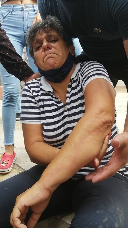 Gabriela Neme, la concejala de Formosa, herida tras la represión policial