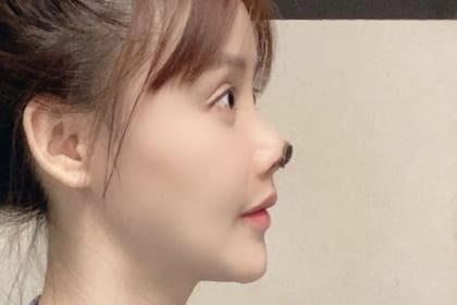 Gao compartió las imágenes con sus cinco millones de seguidores, lo que generó discusiones sobre la cirugía estética, que es extremadamente popular en China