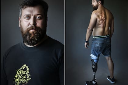 Gastón Pattarini posa dos años después del accidente de tránsito por el que debieron amputarle una pierna. Foto: Fernando Gutierrez