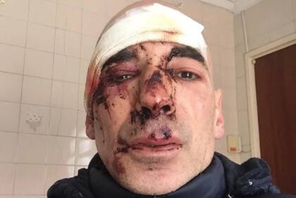 Motociclistas atacaron a Germán Martínez, un runner que se entrenaba para la maratón del domingo