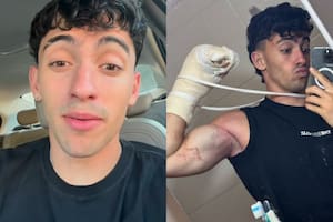 Gero Arias, el influencer que se hizo conocido por el reto de las dominadas, tuvo un accidente (Foto: captura Instagram/@ geroooo_arias)