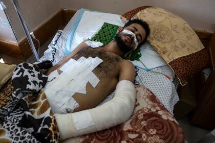 Ghassan Al-masri, de 22 años, descansa en el hospital Shifa en la ciudad de Gaza, el jueves 13 de mayo de 2021, donde recibe tratamiento por las heridas causadas por un ataque israelí del 10 de mayo que golpeó una casa cercana a su familia en la ciudad de Beit Hanoun. Hace apenas unas semanas, el débil sistema de atención médica de la Franja de Gaza estaba luchando con un aumento desbocado de casos de coronavirus. Ahora, los médicos de todo el abarrotado enclave costero están tratando de mantenerse al día con una crisis muy diferente: heridas por explosiones y metralla, cortes y amputaciones. (Foto AP / Khalil Hamra)