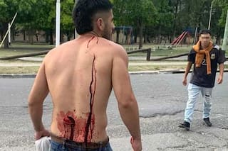 Una patota agredió a tres jóvenes con botellas rotas y cascotes