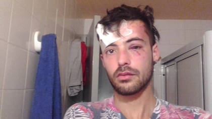 Gonza Valverde, el joven golpeado