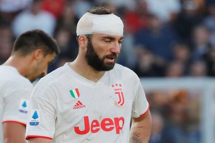 Gonzalo Higuaín terminó el encuentro de Juventus contra Lecce con un vendaje en su cabeza. Quedó mareado, pero no fue hospitalizado al final del partido.