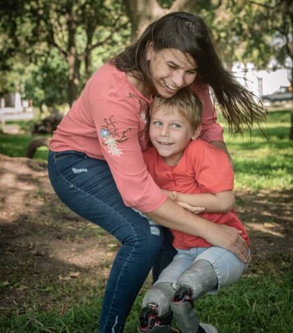 “Gracias a sus prótesis deportivas descubrió el deporte y lo tiene muy entusiasmado”.