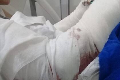 Gravísimas heridas sufrió una mujer atacada por tres perros mientras caminaba por Punta Mogotes