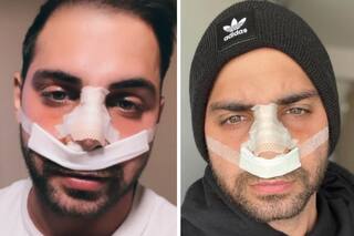 Grego Rosselló debió ser operado: "Tengo más cirugías que Michael Jackson"