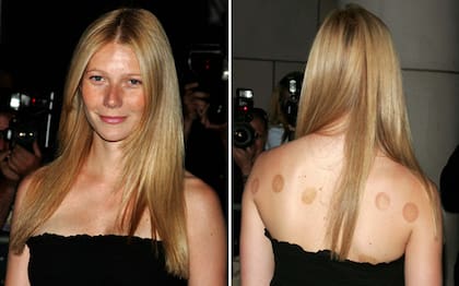 Gwyneth Paltrow es una de las celebridades que más promueve el uso de las ventosas para tratar dolencias