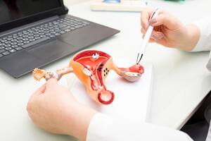 Gynecologist showing uterine structure on a uterus model. Uterus model on gynecologist's desk close-up