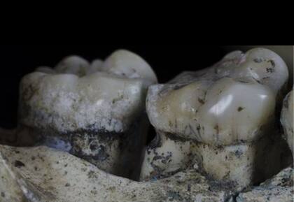 Hace 1.8 millones de años los humanos utilizaban palillos de dientes, indica un estudio científico