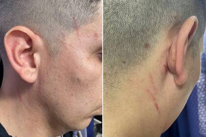 Hallan asesinada a una joven en una zanja de El Talar y detienen como presunto femicida a su pareja