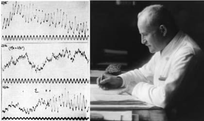 Hans Berger con un electroencefalograma de su hija Ilse, hecho en 1927; las líneas muestran la actividad cerebral de la niña al dormir, al calcular una suma, y al anunciar el resultado