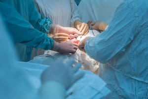 Hasta ahora este tipo de intervención solo se hacía en el sistema privado de salud
