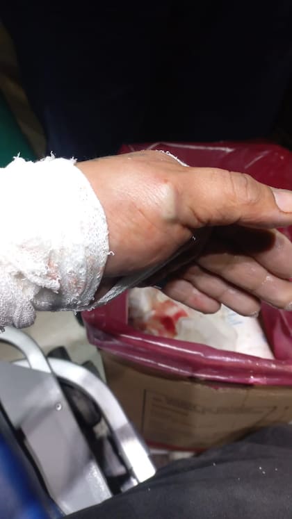 Hasta ahora, no recibió el alta el la Clínica Ima, pero se encuentra fuera de peligro.