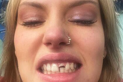 "Hasta que me pasó a mí, nunca me di cuenta de lo traumatizante que es. Y el hecho de que no me diera cuenta muestra que no hay suficiente gente hablando de ello", aseguró