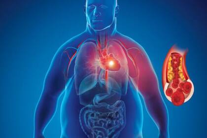 La obesidad es una de las grandes amenazas de nuestros tiempos