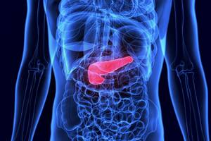 Cómo se detectan y de qué manera se tratan los tumores premalignos de páncreas