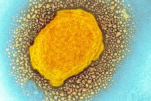 Hay más de 90 casos confirmados en al menos 14 países