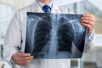 Hay otros cambios que pueden afectar el grado de intensidad de la enfermedad, como el desarrollo de nuevas afecciones de salud o el envejecimiento