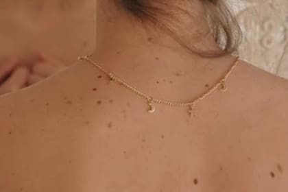 Hay que prestar atención en las manchas en las piel (Foto Pexels)