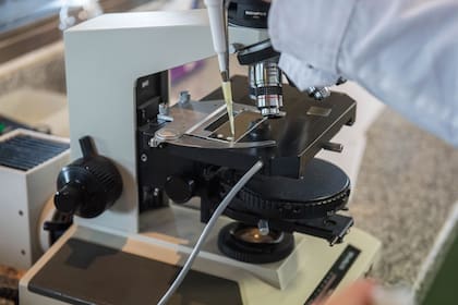 Hay un concepto de vigor de los espermatozoides: la velocidad con la que atraviesan el campo visual del microscopio. 