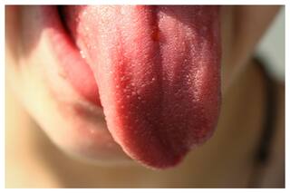 Qué significa tener la lengua blanca