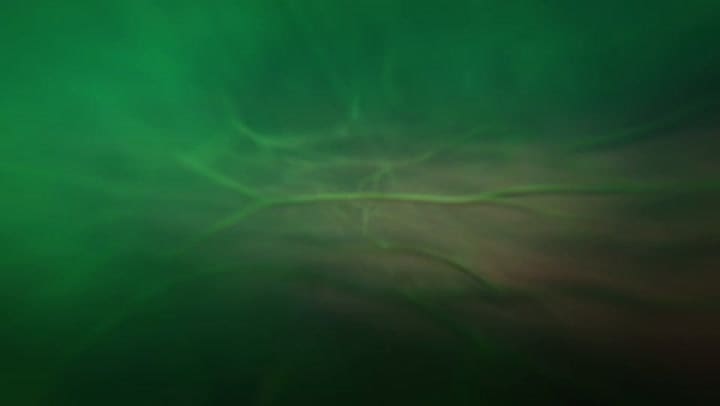 El Apple Watch Series 11 tiene un sensor que te notifica ante una posible hipertensión