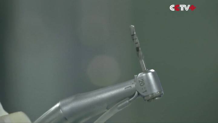 El primer implante dental robotizado del mundo se hizo en China