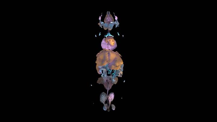 Por primera vez, una inteligencia artificial permite ver cómo una enfermedad altera todo el cuerpo, célula por célula
