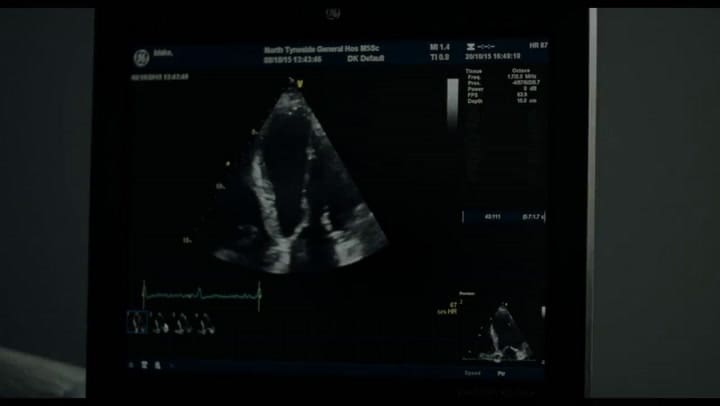 Trailer de Yo, Daniel Blake