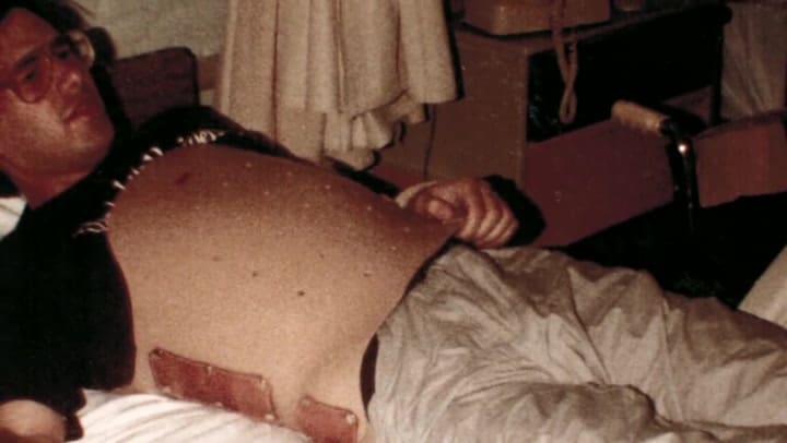 Greg Abbott relató el accidente que lo dejó en silla de ruedas