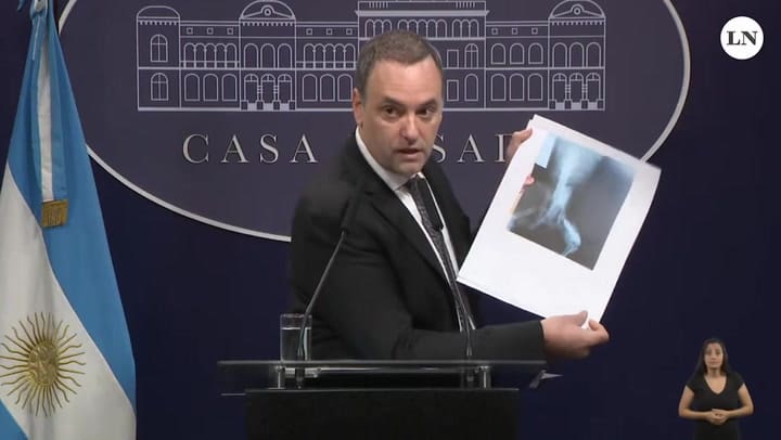 El Gobierno auditará 1,2 millones de pensiones por invalidez laboral: hay expedientes con la radiografía de un perro