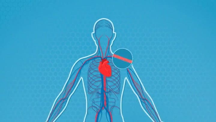 Biolife4d - See Bioprinting In Action