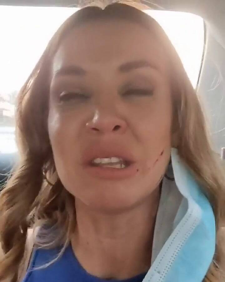 Dallys Ferreira debió ir a un hospital