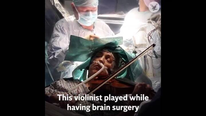 Impresionante: una mujer toca su violín durante una cirugía cerebral