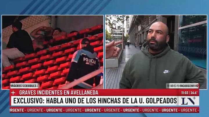 Jean Abreu, un hincha de la U. de Chile golpeado en los incidentes con Independiente