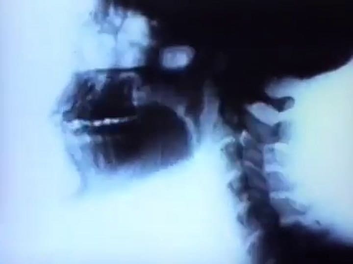 The Offspring - 'Self esteem'