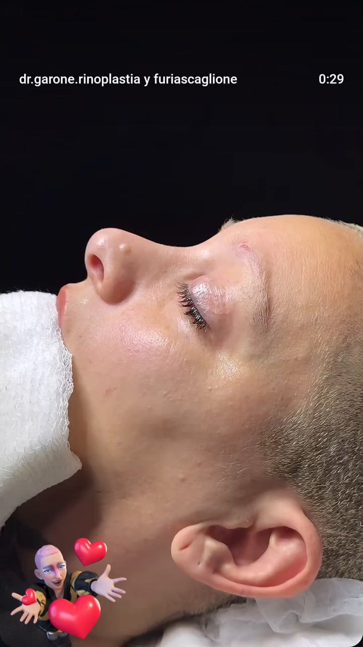 Juliana “Furia” Scaglione se realizó una cirugía estética y sorprendió a sus seguidores