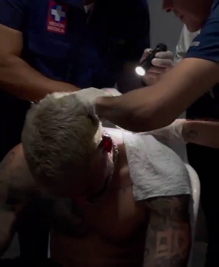 Reykon sufrió grave accidente durante un concierto y terminó prendido en llamas