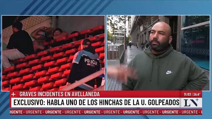 Jean Abreu, hincha de la U. de Chile golpeado