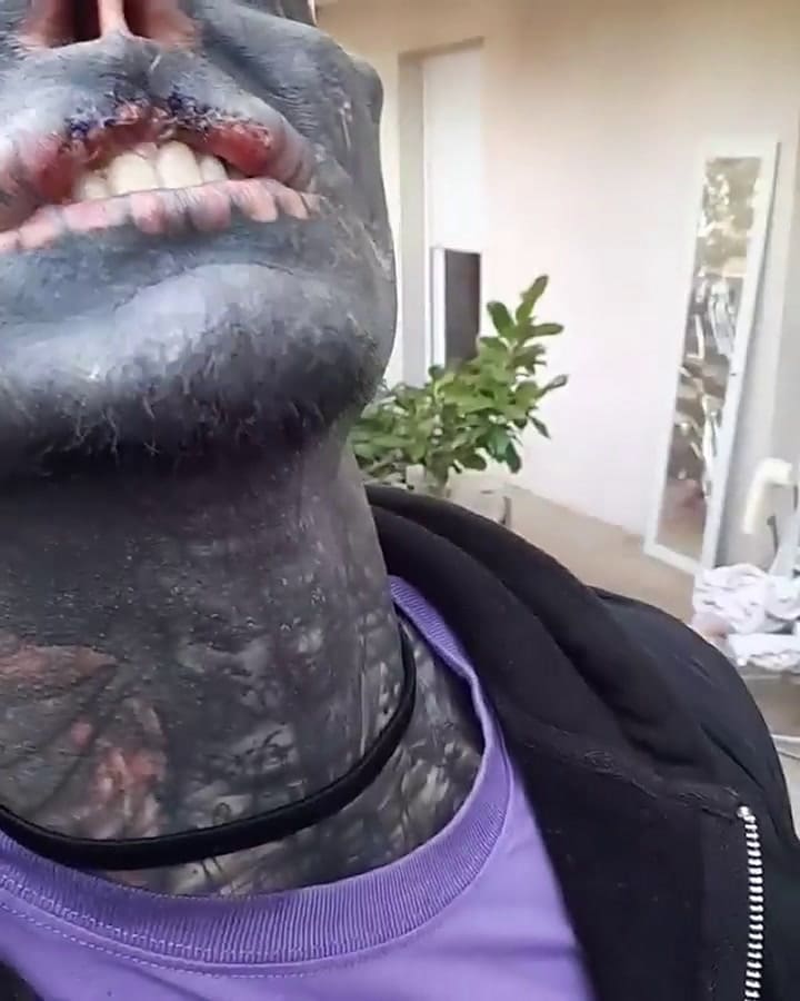 Se quitó la nariz y el labio superior para parecer un alien y ahora le cuesta hablar