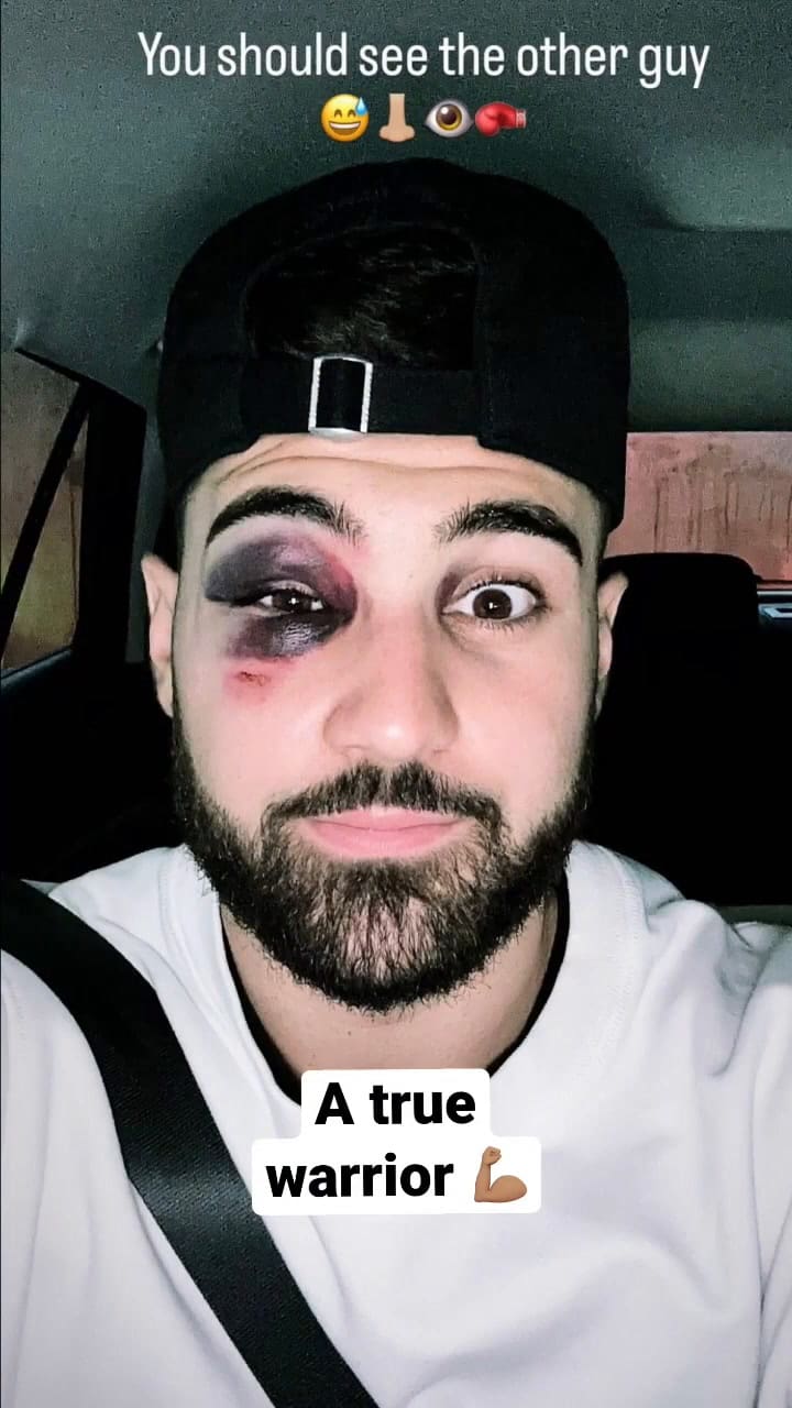 El impactante choque de cabezas entre Gvardiol y Orban