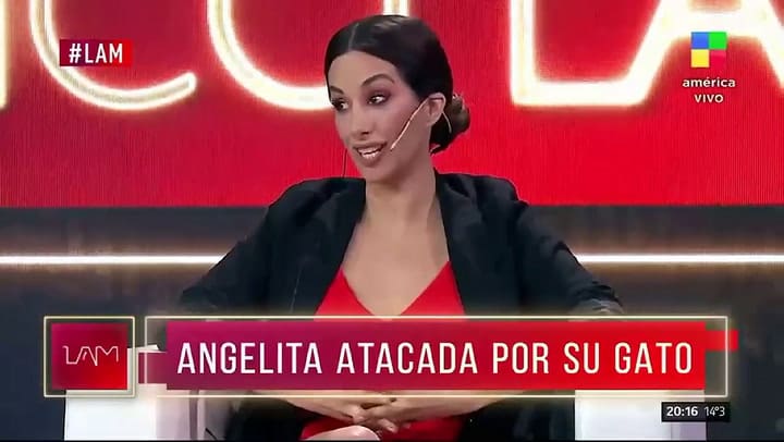 Miriam Lanzoni sufrió un impactante accidente: “Le perforó el ojo'