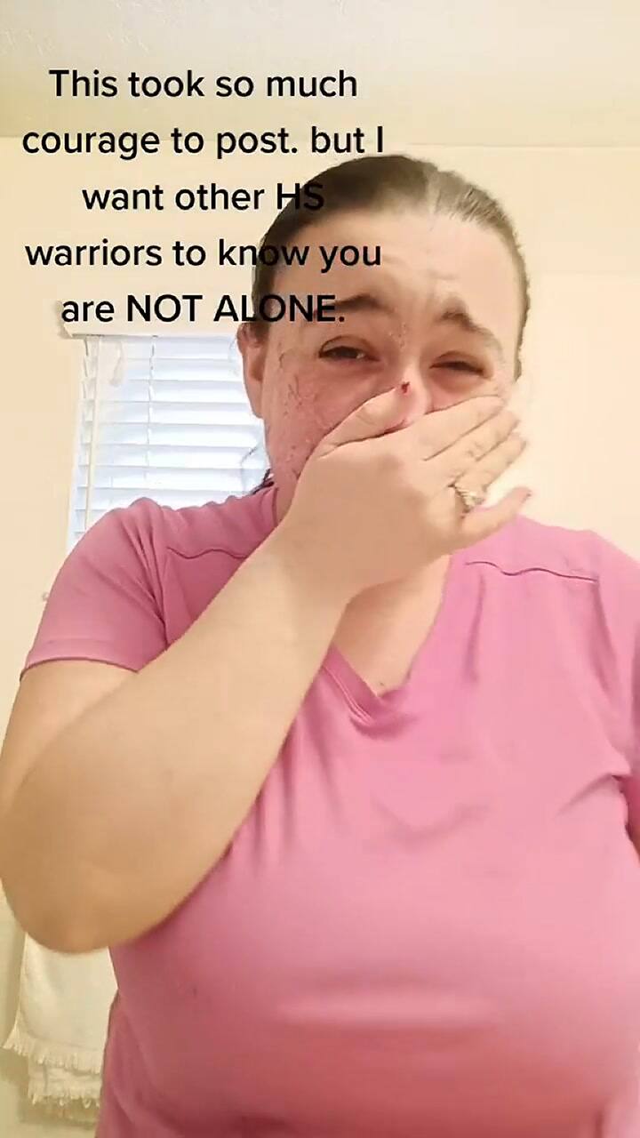 Una mujer es comparada con Freddy Krueger por su aspecto físico