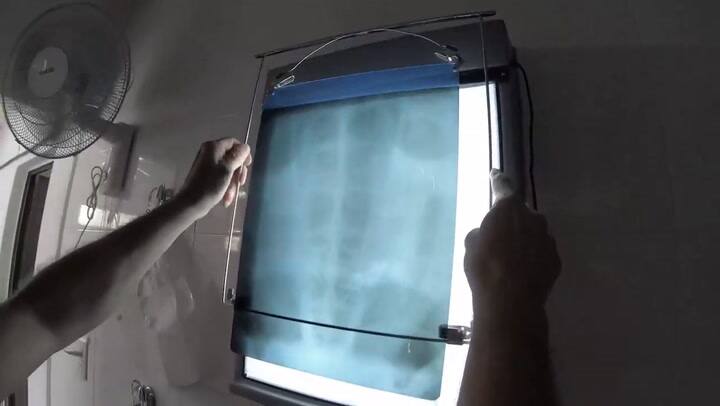 La reinserción de una tortuga que tenía 14 gramos de plástico en su cuerpo - Fuente: Youtube