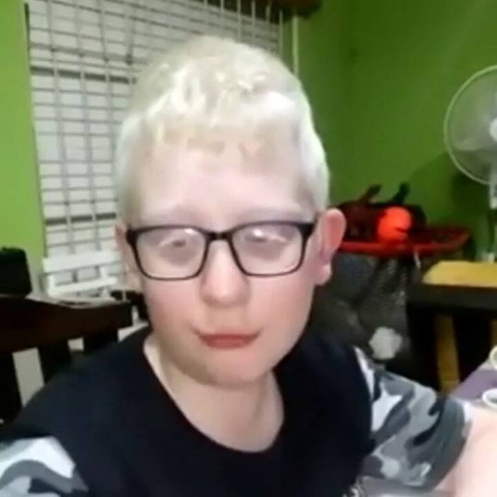 Pedido por la ley de albinismo