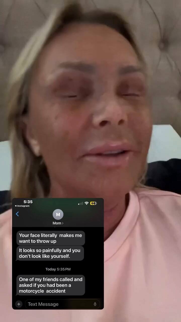 La Reaccion De Esta Madre Luego De Que Su Hija Se Hiciera Un Tratamiento Estetico