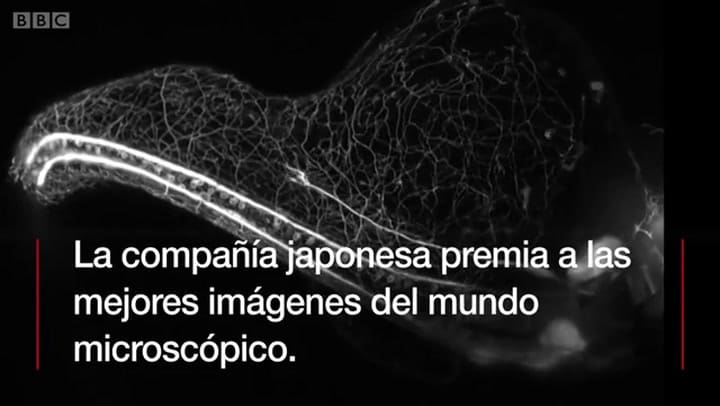 Diminutos, raros y bellos: imágenes de la vida a través de un telescopio - Fuente: BBC